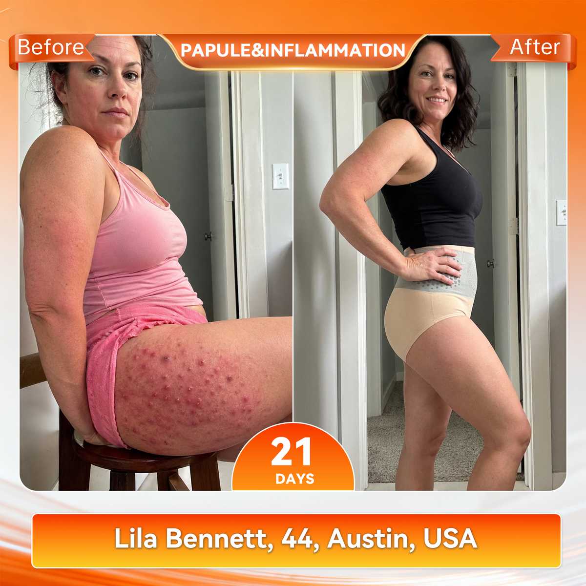 👙𝐊𝐚𝐚𝐋𝐚® 𝟐𝟎𝟐𝟔 𝐌𝐨𝐫𝐢𝐧𝐠𝐚 & 𝐁𝐞𝐫𝐛𝐞𝐫𝐢𝐧𝐞 𝟒-𝐈𝐧-𝟏 𝐌𝐢𝐜𝐫𝐨-𝐏𝐚𝐫𝐭𝐢𝐜𝐥𝐞 𝐒𝐜𝐮𝐥𝐩𝐭𝐢𝐧𝐠 & 𝐅𝐚𝐭-𝐁𝐮𝐫𝐧 𝐒𝐡𝐨𝐫𝐭𝐬