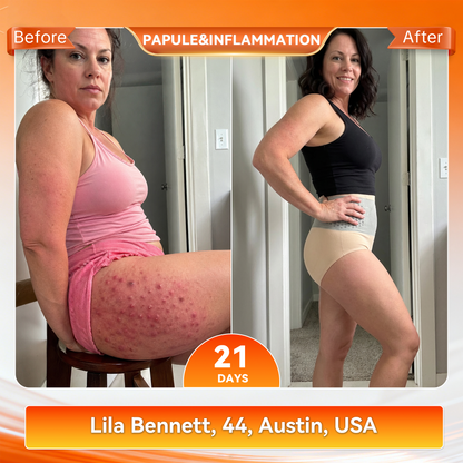 👙𝐊𝐚𝐚𝐋𝐚® 𝟐𝟎𝟐𝟔 𝐌𝐨𝐫𝐢𝐧𝐠𝐚 & 𝐁𝐞𝐫𝐛𝐞𝐫𝐢𝐧𝐞 𝟒-𝐈𝐧-𝟏 𝐌𝐢𝐜𝐫𝐨-𝐏𝐚𝐫𝐭𝐢𝐜𝐥𝐞 𝐒𝐜𝐮𝐥𝐩𝐭𝐢𝐧𝐠 & 𝐅𝐚𝐭-𝐁𝐮𝐫𝐧 𝐒𝐡𝐨𝐫𝐭𝐬