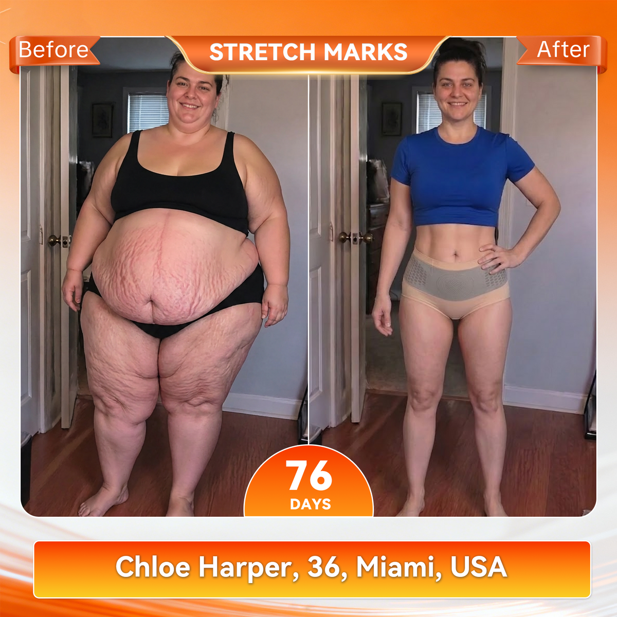 👙𝐊𝐚𝐚𝐋𝐚® 𝟐𝟎𝟐𝟔 𝐌𝐨𝐫𝐢𝐧𝐠𝐚 & 𝐁𝐞𝐫𝐛𝐞𝐫𝐢𝐧𝐞 𝟒-𝐈𝐧-𝟏 𝐌𝐢𝐜𝐫𝐨-𝐏𝐚𝐫𝐭𝐢𝐜𝐥𝐞 𝐒𝐜𝐮𝐥𝐩𝐭𝐢𝐧𝐠 & 𝐅𝐚𝐭-𝐁𝐮𝐫𝐧 𝐒𝐡𝐨𝐫𝐭𝐬