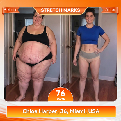👙𝐊𝐚𝐚𝐋𝐚® 𝟐𝟎𝟐𝟔 𝐌𝐨𝐫𝐢𝐧𝐠𝐚 & 𝐁𝐞𝐫𝐛𝐞𝐫𝐢𝐧𝐞 𝟒-𝐈𝐧-𝟏 𝐌𝐢𝐜𝐫𝐨-𝐏𝐚𝐫𝐭𝐢𝐜𝐥𝐞 𝐒𝐜𝐮𝐥𝐩𝐭𝐢𝐧𝐠 & 𝐅𝐚𝐭-𝐁𝐮𝐫𝐧 𝐒𝐡𝐨𝐫𝐭𝐬